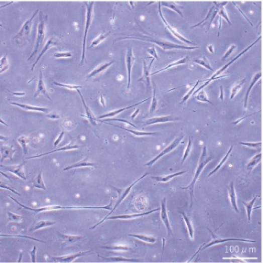 初代ヒト線維芽細胞の写真
